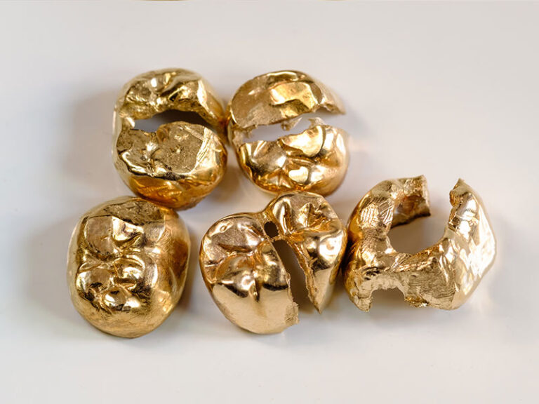 Zähne aus Gold, die für den Ankauf bestimmt sind